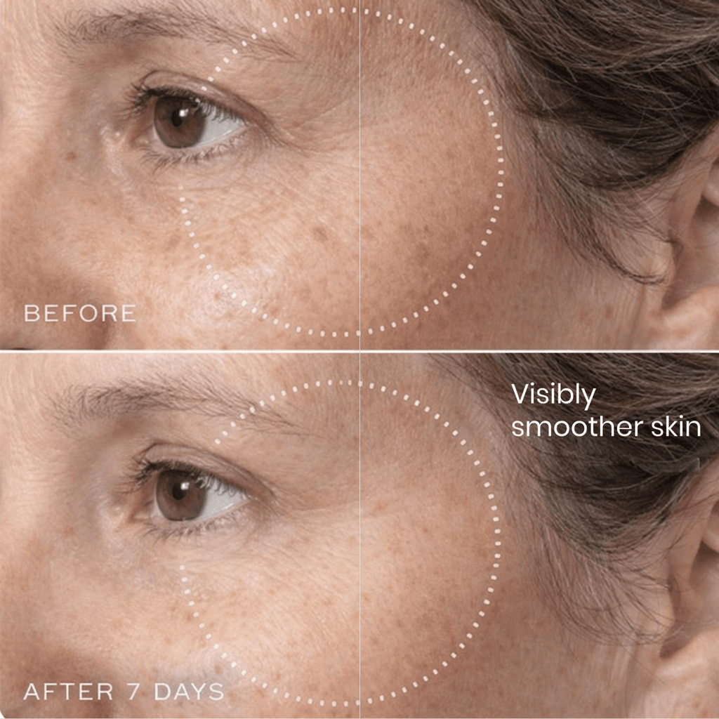 Brightr® Eye wrinkle smoothing patches - Joe’s Haven