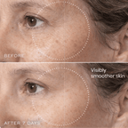 Brightr® Eye wrinkle smoothing patches - Joe’s Haven