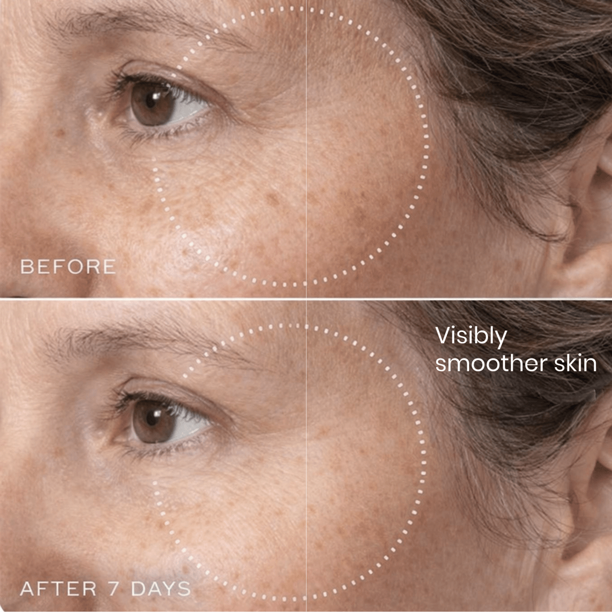 Brightr® Eye wrinkle smoothing patches - Joe’s Haven