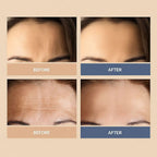 Brightr® Forehead wrinkle smoothing Face Tape (30 patches) - Joe’s Haven